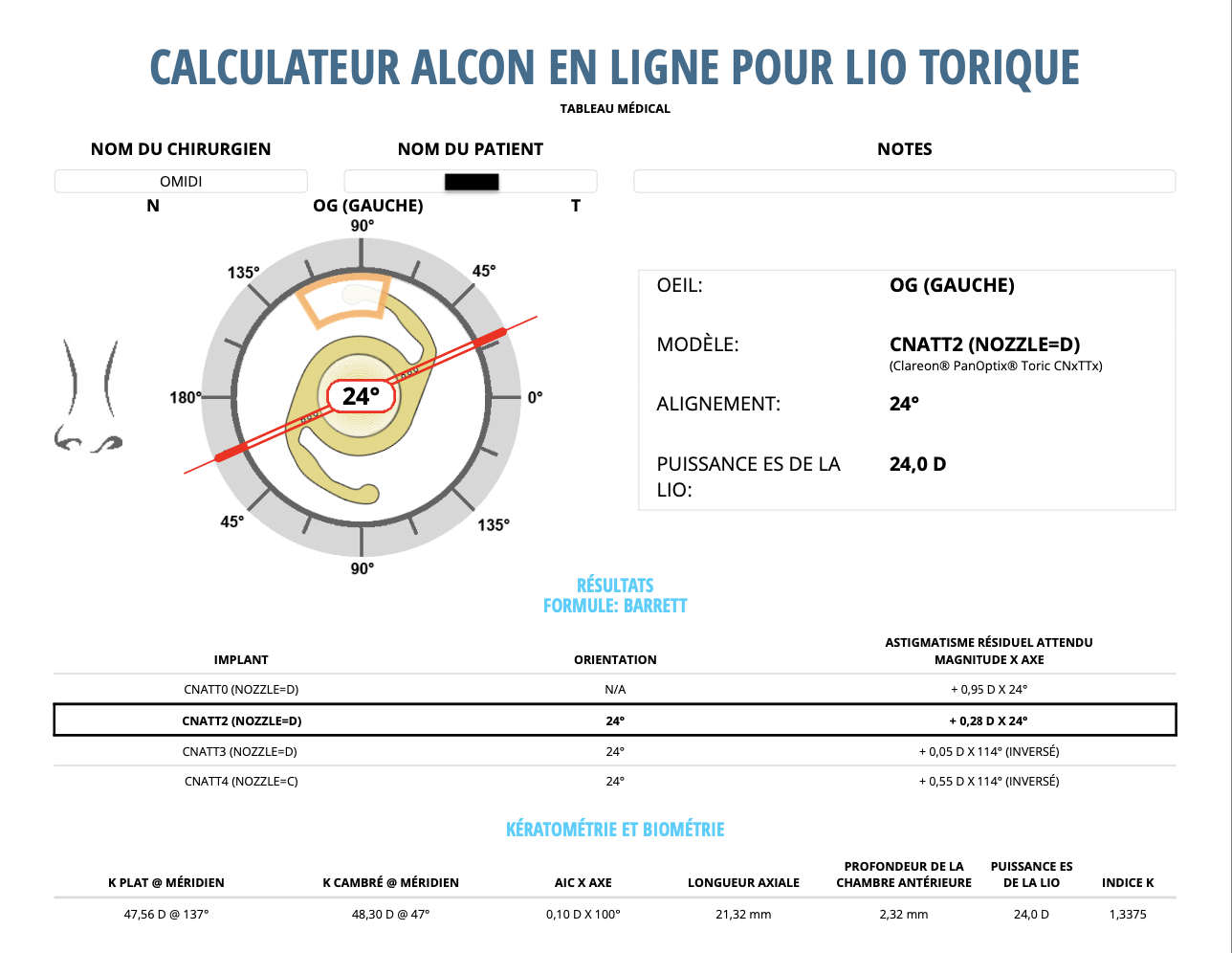 Calculateur en ligne pour le choix d'un implant intraoculaire torique
